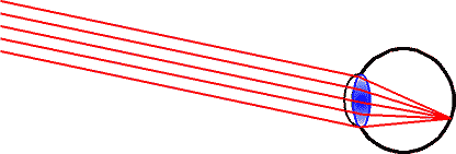 Paralleles Licht fällt ins Auge